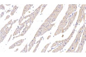 Detection of PDL1 in Rat Cardiac Muscle Tissue using Monoclonal Antibody to Programmed Cell Death Protein 1 Ligand 1 (PDL1) (PD-L1 Antikörper  (AA 34-241))