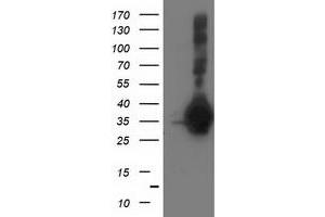 Western Blotting (WB) image for anti-Sirtuin 5 (SIRT5) antibody (ABIN1500933)