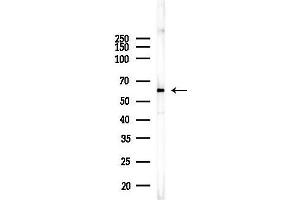 anti-Chaperonin Containing TCP1, Subunit 8 (Theta) (CCT8) (Internal Region) antibody
