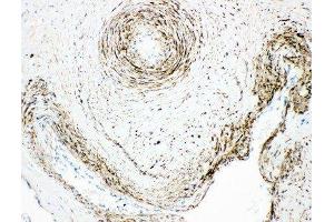Anti-Monoamine Oxidase A antibody, IHC(P) IHC(P): Human Placenta Tissue