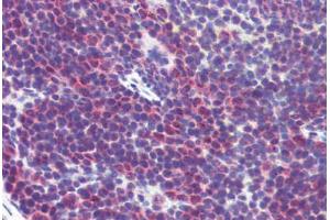 Immunohistochemistry (Formalin-fixed Paraffin-embedded Sections) (IHC (fp)) image for anti-CD36 (CD36) (AA 99-114) antibody (ABIN2618488)