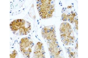 Immunohistochemistry of paraffin-embedded Human stomach using C8orf4 Polyclonal Antibody at dilution of 1:100 (40x lens). (C8orf4 Antikörper)