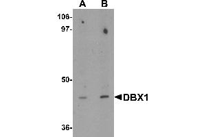 Western blot analysis of DBX1 in mouse kidney tissue lysate with DBX1 antibody at (A) 1 and (B) 2 µg/mL. (DBX1 Antikörper  (Middle Region))
