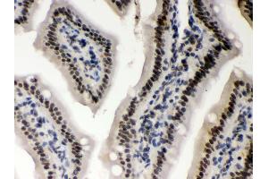 Anti- CSNK1A1 Picoband antibody,IHC(P) IHC(P): Mouse Intestine Tissue