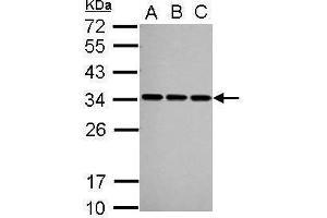 WB Image Sample (30 ug of whole cell lysate) A: A549 B: HeLa C: HepG2 12% SDS PAGE antibody diluted at 1:1000 (SNRPA1 Antikörper  (C-Term))