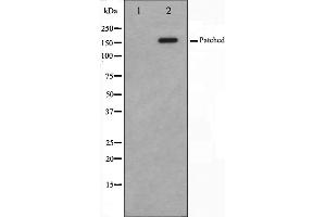 Western blot analysis of Patched expression in mouse muscle cells,The lane on the left is treated with the antigen-specific peptide.