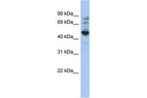 Image no. 1 for anti-Preferentially Expressed Antigen in Melanoma (PRAME) (AA 71-120) antibody (ABIN6743941) (PRAME Antikörper  (AA 71-120))