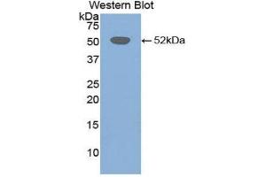 Western Blotting (WB) image for anti-Fibrinogen beta Chain (FGB) (AA 35-481) antibody (ABIN1858854)