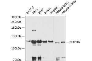 Western blot analysis of extracts of various cell lines, using NUP107 antibody (ABIN6129528, ABIN6144947, ABIN6144948 and ABIN6216980) at 1:3000 dilution. (NUP107 Antikörper  (AA 766-925))