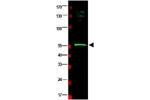 Image no. 1 for anti-RAD23 Homolog B (RAD23B) (AA 163-176) antibody (ABIN401177) (RAD23B Antikörper  (AA 163-176))