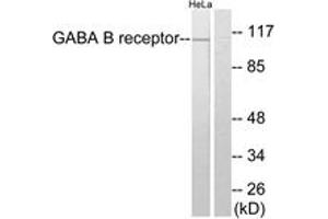 Western blot analysis of extracts from HeLa cells, using GABA-B Receptor Antibody. (GABBR1 Antikörper  (AA 871-920))