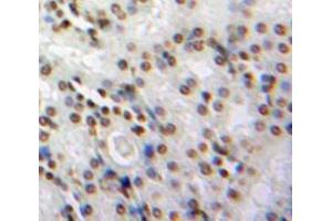 Used in DAB staining on fromalin fixed paraffin-embedded Kidney tissue (NMES1 Antikörper  (AA 1-83))