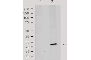 Western blot analysis of extracts from rat brain, using MRPL20 Antibody.