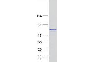 Validation with Western Blot
