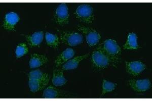 anti-Carbamoyl-Phosphate Synthetase 2, Aspartate Transcarbamylase, and Dihydroorotase (CAD) (AA 1403-2198) antibody