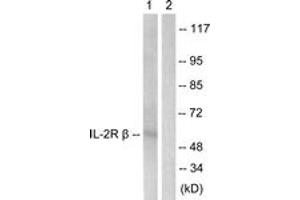 Western blot analysis of extracts from HepG2 cells, using IL-2R beta (Ab-364) Antibody. (IL2 Receptor beta Antikörper  (AA 331-380))