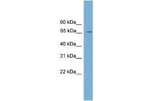 WB Suggested Anti-L3mbtl Antibody Titration:  0. (L3MBTL1 Antikörper  (Middle Region))