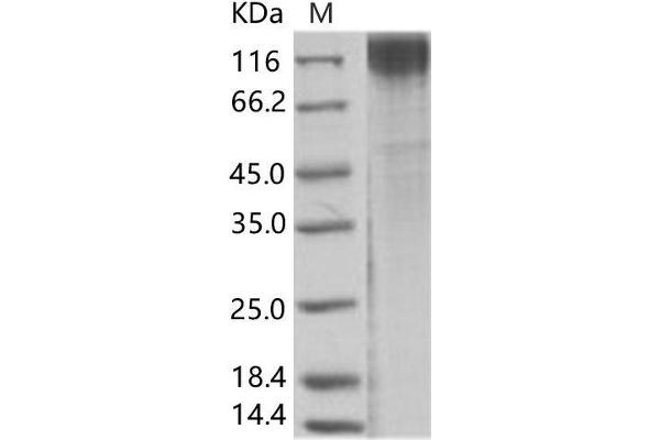 Simian Immunodeficiency Virus Surface Glycoprotein (SIV gp120) protein (His tag)