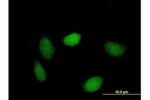 Immunofluorescence of purified MaxPab antibody to LSM1 on HeLa cell. (LSM1 Antikörper  (AA 1-133))