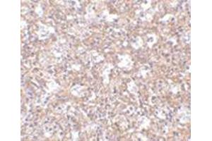 Immunohistochemistry of TEM4 in human spleen tissue with this product at 2. (ARHGEF17 Antikörper  (Center))