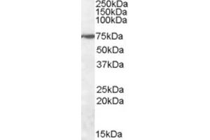 Western Blotting (WB) image for anti-Zinc Finger Protein 803 (ZNF803) (Internal Region) antibody (ABIN2464204) (WIZ Antikörper  (Internal Region))