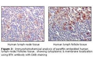 Image no. 1 for anti-Bruton Agammaglobulinemia tyrosine Kinase (BTK) antibody (ABIN232137) (BTK Antikörper)
