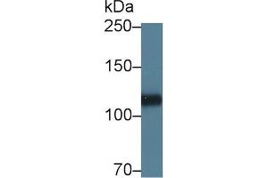 Western blot analysis of Pig Heart lysate, using Human HSPG2 Antibody (5 µg/ml) and HRP-conjugated Goat Anti-Rabbit antibody ( (HSPG2 Antikörper  (AA 4149-4391))