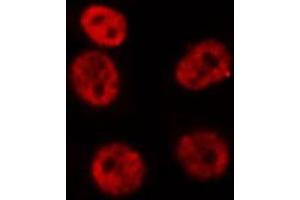 ABIN6276949 staining HepG2? (HOXA9 Antikörper  (Internal Region))