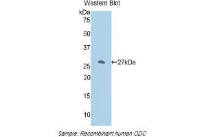 Western blot analysis of the recombinant protein. (ODC1 Antikörper  (AA 234-453))