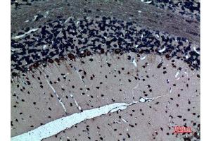 Immunohistochemistry (IHC) analysis of paraffin-embedded Rat Brain, antibody was diluted at 1:100.