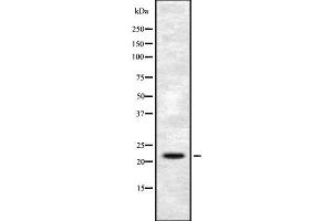 Western blot analysis FGF6 using HuvEc whole cell lysates (FGF6 Antikörper  (N-Term))