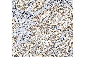 IHC analysis of TRIR using anti-TRIR antibody (ABIN7603244). (Uncharacterized Protein C19orf43 (TRIR) (N-Term) Antikörper)