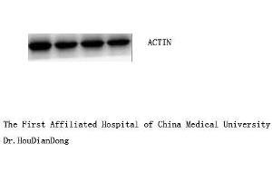 Western Blot (WB) analysis: Please contact us for more details. (beta Actin Antikörper  (N-Term))
