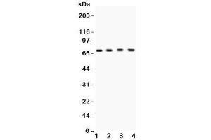 Western blot testing of Kv4. (KCND1 Antikörper  (AA 442-647))
