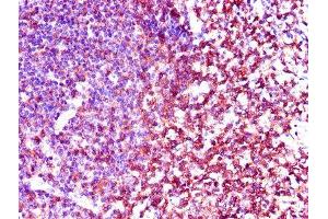 Immunohistochemistry of paraffin-embedded human tonsil tissue using ABIN7174038 at dilution of 1:100 (LCK Antikörper  (AA 1-539))