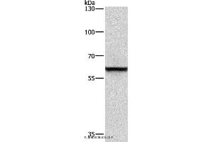 Western blot analysis of A431 cell, using TRIP4 Polyclonal Antibody at dilution of 1:400 (TRIP4 Antikörper)