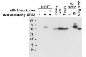 Image no. 1 for anti-Selenophosphate Synthetase 2 (SEPHS2) antibody (ABIN300064) (SEPHS2 Antikörper)