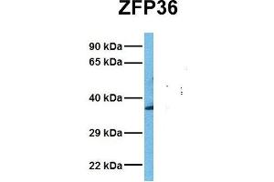 Host:  Rabbit  Target Name:  ZFP36  Sample Tissue:  Human Fetal Liver  Antibody Dilution:  1. (ZFP36 Antikörper  (N-Term))