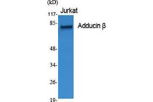Western Blot (WB) analysis of specific cells using Adducin beta Polyclonal Antibody. (ADD2 Antikörper  (Internal Region))