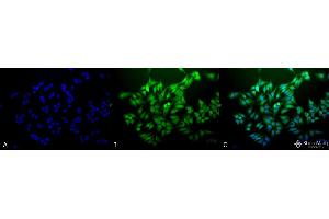 Immunocytochemistry/Immunofluorescence analysis using Mouse Anti-Ubiquitin Monoclonal Antibody, Clone 6C11-B3 . (Ubiquitin Antikörper  (Atto 390))