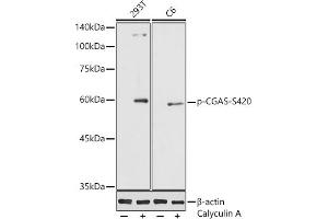 Western blot analysis of extracts of various cell lines, using Phospho-CGAS-S420 antibody (ABIN7266387) at 1:1000 dilution. (C6orf150 Antikörper  (pSer420))