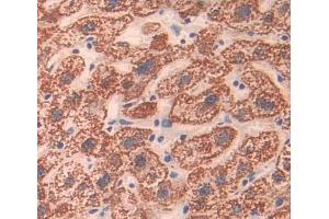 Used in DAB staining on fromalin fixed paraffin- embedded liver tissue (ABCA8 Antikörper  (AA 1263-1456))