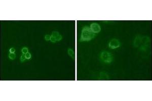 Immunofluorescence analysis of Hela (Left) and MCF-7 (Right) cells using Tyro3 antibody (green). (TYRO3 Antikörper  (AA 138-321))