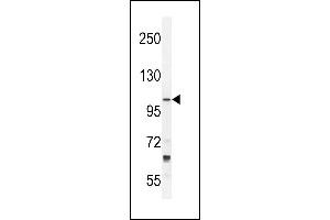 TLL2 Antibody (N-term) (ABIN392519 and ABIN2842079) western blot analysis in NCI- cell line lysates (35 μg/lane). (Tolloid-Like 2 Antikörper  (N-Term))