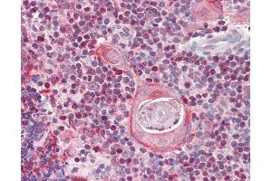 Anti-SATB1 antibody IHC of human thymus. (SATB1 Antikörper  (AA 668-681))