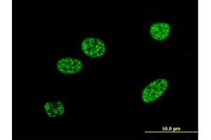 Immunofluorescence of monoclonal antibody to BNIP3L on HeLa cell. (BNIP3L/NIX Antikörper  (AA 43-130))