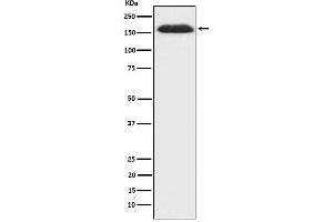 Western blot analysis of SUPT5H expression in HepG2 cell lysate.