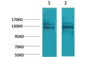 Western Blotting (WB) image for anti-Calcium-Sensing Receptor (CASR) antibody (ABIN3181546) (CASR Antikörper)