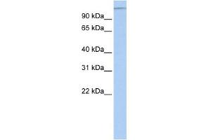 WB Suggested Anti-MTUS1 Antibody Titration:  0. (MTUS1 Antikörper  (Middle Region))