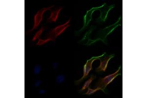 ABIN6266305 and ABIN6277424 staining Hela cells by IF/ICC. (PDK4 Antikörper  (C-Term))